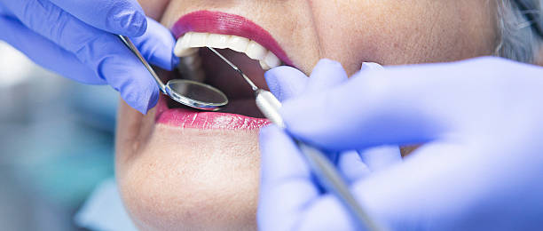 Best Emergency Dentist for Lost Fillings or Crowns in Menlo Park Terrace, NJ